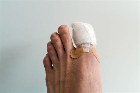 teen toes|Toe Injuries .